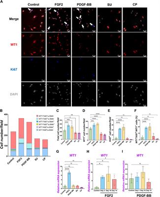 FGF2 promotes the expansion of parietal mesothelial progenitor pools and inhibits BMP4-mediated smooth muscle cell differentiation